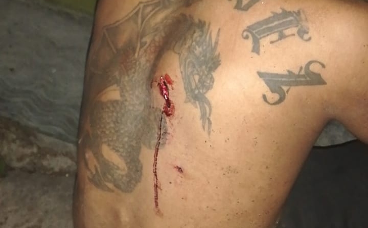 Termina convivencia en Playa del Carmen con sujeto apuñalado