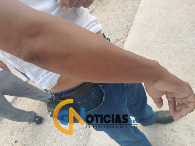 Violencia en la COR 80: Acusan a Noel Gallegos Bautista de ordenar golpiza contra operador
